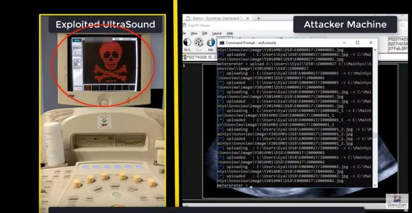 Hackerare un ecografo e rubare i dati clinici di un paziente è fin troppo facile