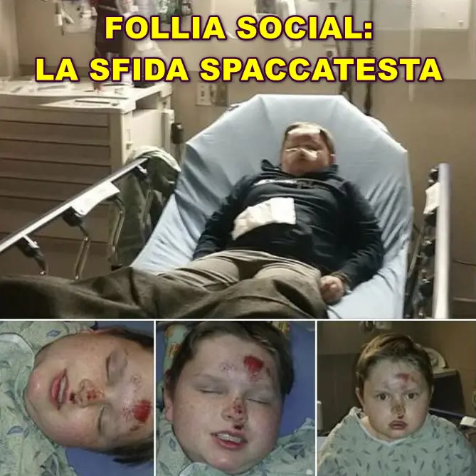 Skullbreaker Challenge, l’ultima follia social è un tranello spacca-testa – Calci nell’ano, visi sfregiati. Si può morire